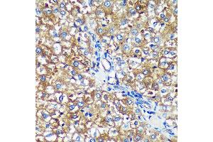 Immunohistochemistry of paraffin-embedded Rat liver using PYCR2 Rabbit pAb (ABIN7269766) at dilution of 1:100 (40x lens). (PYCR2 Antikörper  (AA 271-320))