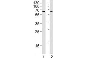 YY1 antibody western blot analysis in Daudi and U251 lysate. (YY1 Antikörper)