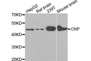 Western blot analysis of extracts of various cell lines, using CNP antibody. (Cnpase Antikörper)