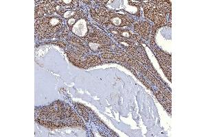 IHC analysis of TRMT61A using anti-TRMT61A antibody (ABIN7599220).