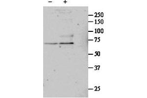 ABIN571032 (1µg/ml) staining of untreated (first lane) and TGF-bl-treated (second lane) primary cultured Human Lung fibroblast lysate. (SRF Antikörper  (Internal Region))
