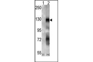Western blot analysis of EphA6 (arrow) using rabbit polyclonal EphA6 Antibody. (EPH Receptor A6 Antikörper)