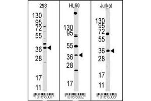 Western blot analysis of anti-HIF1AN Pab in 293, HL60 and Jurkat cell line lysates (HIF1AN Antikörper  (N-Term))