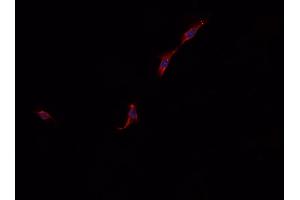 ABIN6268931 staining A549 cells by IF/ICC.