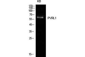 Western Blot (WB) analysis of KB cells using Nectin 1 Polyclonal Antibody.
