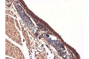 Immunohistochemistry analysis using Mouse Anti-Sodium Iodide Symporter Monoclonal Antibody, Clone 14F . (SLC5A5 Antikörper  (AA 468-643) (Atto 594))