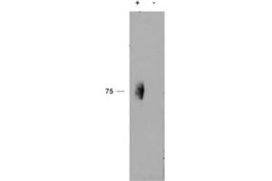Western blot testing of immunoprecipitate from a lysate of human natural killer cells with (+) or without (-) pervanadate treatment of the cells using phospho-CD244 antibody at 2ug/ml. (2B4 Antikörper)