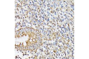 Immunohistochemistry of paraffin-embedded human appendix using RHOG antibody (ABIN7269864) at dilution of 1:100 (40x lens). (RHOG Antikörper)