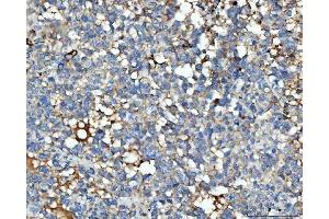 IHC analysis of THBS3 using anti-THBS3 antibody (ABIN7600759). (THBS3 Antikörper  (AA 23-486))