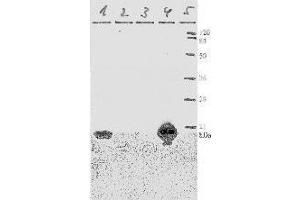 anti-Human Papilloma Virus 11 E7 (HPV-11 E7) (AA 36-70) antibody