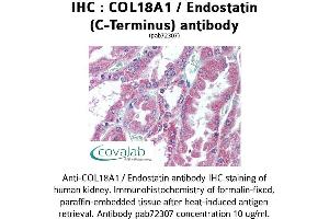 Image no. 1 for anti-Collagen, Type XVIII, alpha 1 (COL18A1) antibody (ABIN1733192) (COL18A1 Antikörper)