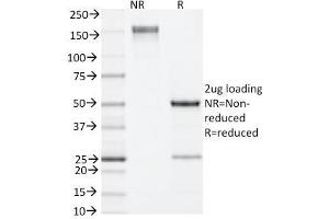 SDS-PAGE Analysis Purified IL-4 Rat Monoclonal Antibody (11B11). (IL-4 Antikörper)