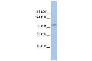 WB Suggested Anti-DDX24  Antibody Titration: 0.