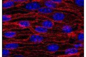 Immunofluorescence (IF) image for anti-Cadherin 5 (CDH5) (Extracellular Domain) antibody (FITC) (ABIN1105885) (Cadherin 5 Antikörper  (Extracellular Domain) (FITC))