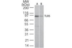 Image no. 2 for anti-Toll-Like Receptor 5 (TLR5) (AA 700-800) antibody (ABIN208231)