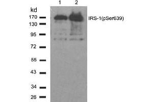 Image no. 2 for anti-Insulin Receptor Substrate 1 (IRS1) (pSer639) antibody (ABIN196981) (IRS1 Antikörper  (pSer639))