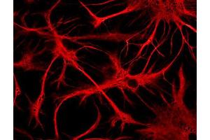 Indirect immunostaining of cultured rat astrocytes (dilution 1 : 500).