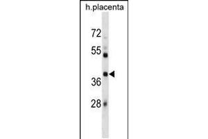 Western blot analysis in human placenta tissue lysates (35ug/lane). (SIAH1 Antikörper  (AA 92-120))