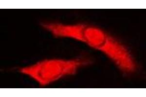 Immunofluorescent analysis of RAD23B staining in HuvEc cells. (RAD23B Antikörper  (N-Term))