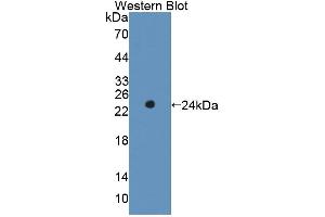 Western blot analysis of the recombinant protein. (RIPK1 Antikörper  (AA 1-179))