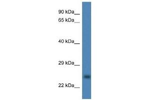 Western Blot showing CCS antibody used at a concentration of 1 ug/ml against Fetal Liver Lysate (Superoxide dismutase copper chaperone Antikörper  (Middle Region))
