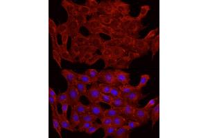 Immunofluorescence (IF) image for anti-Solute Carrier Family 2 (Facilitated Glucose Transporter), Member 4 (SLC2A4) (C-Term) antibody (ABIN6147963)
