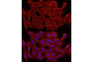 Immunofluorescence analysis of C2C12 cells using GLUT4 antibody (ABIN6134112, ABIN6147963, ABIN6147964 and ABIN6223551) at dilution of 1:100 (40x lens). (GLUT4 Antikörper  (C-Term))