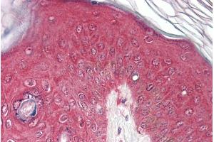 Immunohistochemistry (IHC) image for anti-Proteasome (Prosome, Macropain) Subunit, beta Type, 4 (PSMB4) (Internal Region) antibody (ABIN5539640)