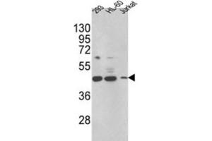 Western Blotting (WB) image for anti-Hydroxysteroid (17-Beta) Dehydrogenase 7 (HSD17B7) antibody (ABIN3002789) (HSD17B7 Antikörper)