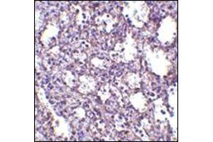 Immunohistochemistry of STIM2 in human spleen tissue with this product at 2. (Stim2 Antikörper  (Center))