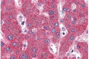 Human Liver (formalin-fixed, paraffin-embedded) stained with SERPINF2 antibody ABIN351490 at 3. (alpha 2 Antiplasmin Antikörper  (AA 454-468))