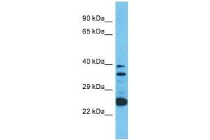 Western Blotting (WB) image for anti-Olfactory Receptor, Family 2, Subfamily A, Member 12 (OR2A12) (C-Term) antibody (ABIN2791718) (OR2A12 Antikörper  (C-Term))