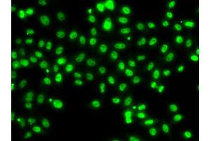 Immunofluorescence analysis of MCF7 cell using SETBP1 antibody. (SETBP1 Antikörper)