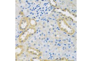 Immunohistochemistry of paraffin-embedded rat kidney using PMPCB antibody at dilution of 1:100 (x40 lens). (PMPCB Antikörper)