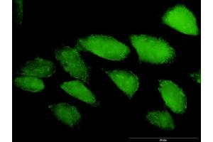 Immunofluorescence (IF) image for anti-Caspase 3 (CASP3) (AA 1-277) antibody (ABIN949992)