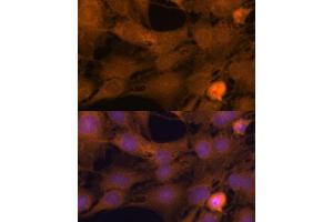 Immunofluorescence analysis of C6 cells using ZC3H7A antibody (ABIN6131068, ABIN6150400, ABIN6150401 and ABIN6217095) at dilution of 1:100. (ZC3H7A Antikörper  (AA 1-220))