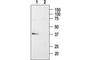anti-Purinergic Receptor P2Y, G-Protein Coupled, 13 (P2RY13) (AA 119-134), (Cytoplasmic) antibody