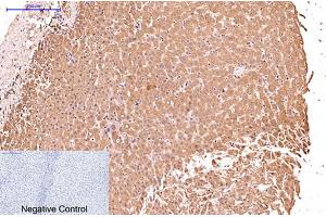 Immunohistochemical analysis of paraffin-embedded human liver tissue. (KRT17 Antikörper)