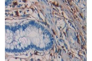 Immunohistochemistry (IHC) image for anti-Tryptase alpha/beta 1 (TPSAB1) (AA 161-262) antibody (ABIN7428305)