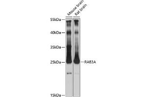 Western blot analysis of extracts of various cell lines, using RA antibody (ABIN7269809) at 1:3000 dilution. (RAB3A Antikörper  (AA 100-200))