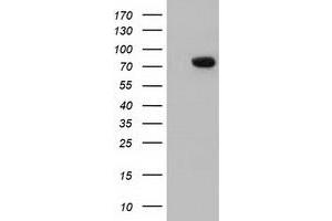 Western Blotting (WB) image for anti-rho GTPase Activating Protein 25 (ARHGAP25) antibody (ABIN1496704)