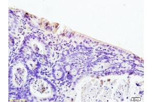Immunohistochemistry (Paraffin-embedded Sections) (IHC (p)) image for anti-Nuclear Receptor Subfamily 1, Group I, Member 2 (NR1I2) (AA 101-150) antibody (ABIN738816)