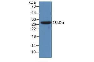 Detection of Recombinant CYP1A1, Human using Polyclonal Antibody to Cytochrome P450 1A1 (CYP1A1) (CYP1A1 Antikörper  (AA 1-250))