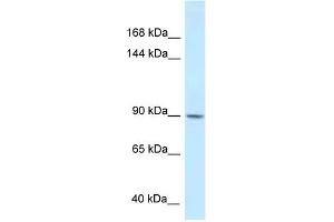 WB Suggested Anti-DACT1 Antibody Titration: 1. (DACT1 Antikörper  (Middle Region))