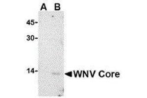 Western Blotting (WB) image for anti-2'-5' Oligoadenylate Synthetase 1B (OAS1B) (C-Term) antibody (ABIN2477148) (OAS1B Antikörper  (C-Term))