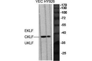 Western Blot (WB) analysis of specific cells using EKLF/CKLF/UKLF Polyclonal Antibody. (EKLF/CKLF/UKLF (C-Term) Antikörper)