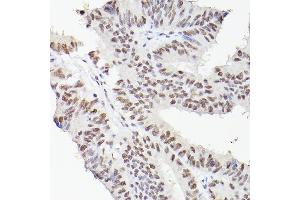 Immunohistochemistry (IHC) image for anti-Leo1, Paf1/RNA Polymerase II Complex Component, Homolog (S. Cerevisiae) (LEO1) antibody (ABIN6133790)