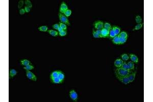 Immunofluorescent analysis of PC-3 cells using ABIN7145043 at dilution of 1:100 and Alexa Fluor 488-congugated AffiniPure Goat Anti-Rabbit IgG(H+L) (ATAD3B Antikörper  (AA 1-240))