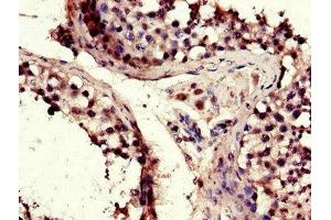 Immunohistochemistry of paraffin-embedded human testis tissue using ABIN7172803 at dilution of 1:100 (TACC3 Antikörper  (AA 133-268))