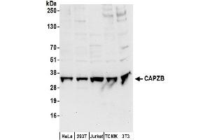 anti-Capping Protein (Actin Filament) Muscle Z-Line, beta (CAPZB) (AA 25-75) antibody